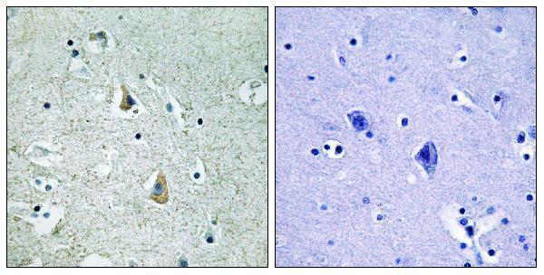 a00075s446 braf primary antibodies ihc testing 4