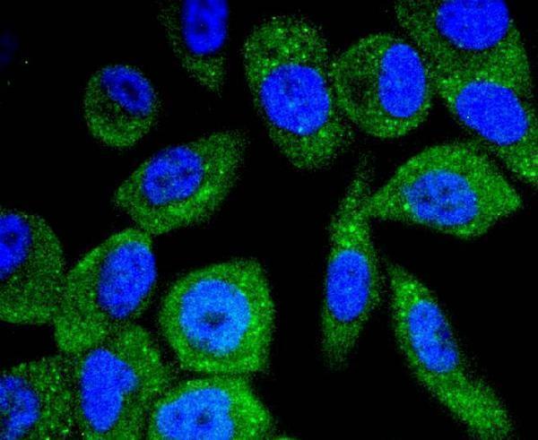 ICC staining Phospho-B Raf(T401) in PC-3M cells (green)