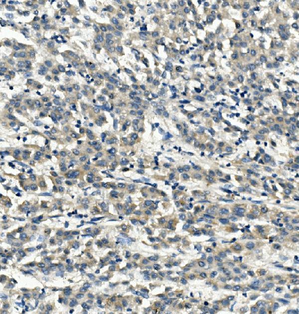  IHC analysis of LDLR using anti-LDLR antibody (A00076-2)