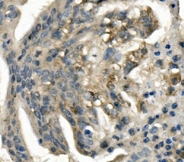  IHC analysis of LDLR using anti-LDLR antibody (A00076-2)