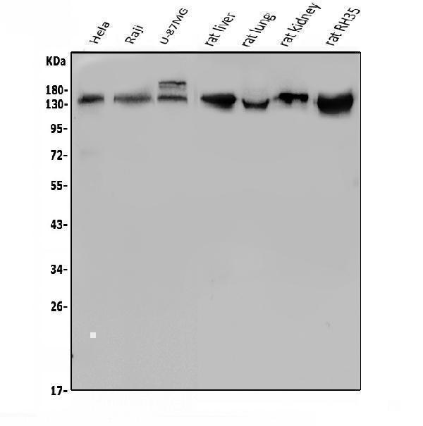  Western blot analysis of LDLR using anti-LDLR antibody (A00076-2)