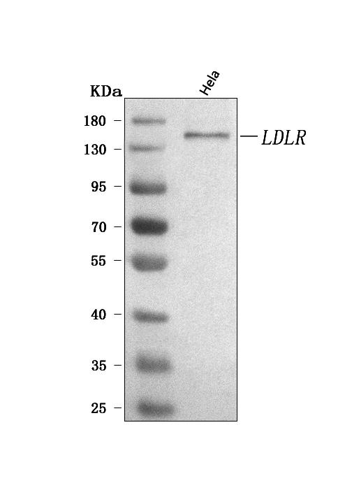  Western blot analysis of LDLR using anti-LDLR antibody (A00076-3)