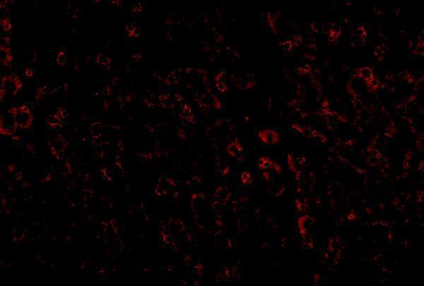 Immunofluorescence of LDLR in human liver tissue with LDLR antibody at 20 μg/mL