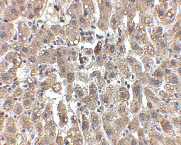 Immunohistochemistry of LDL-R in human liver tissue with LDL-R antibody at 2