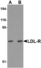 Western blot analysis of LDL-R in human liver tissue lysate with LDL-R antibody at (A) 1 and (B) 2 μg/mL