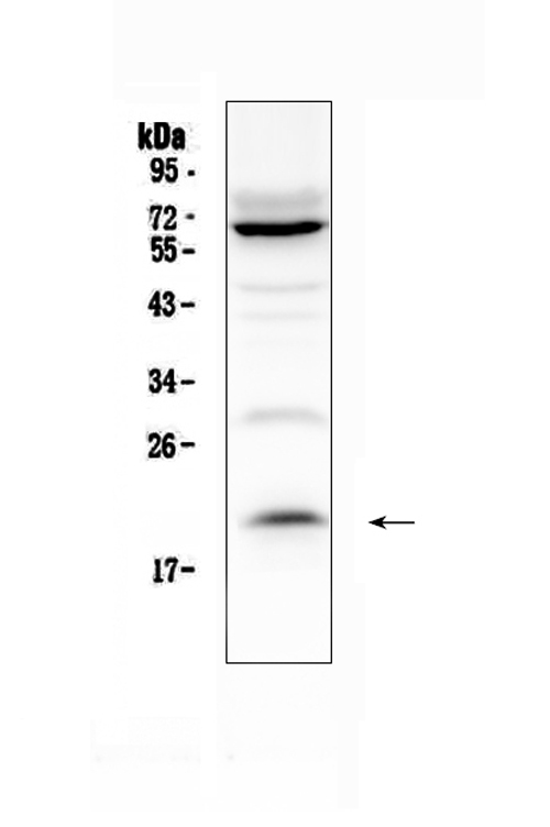  Western blot analysis of IL13 using anti-IL13 antibody (A00077)