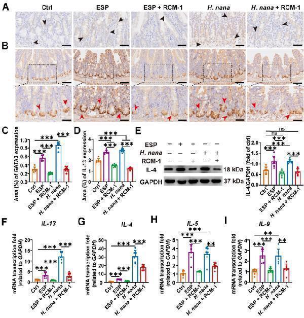RCM-1 prevents type 2 cytokines expression in mice to expel H 