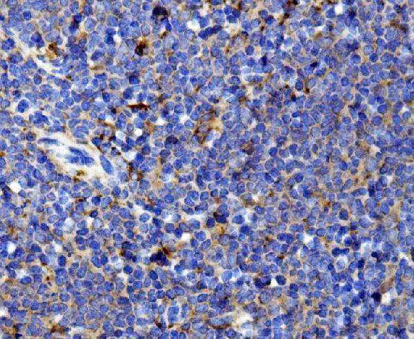 a00077 2 il13 primary antibodies ihc testing 2
