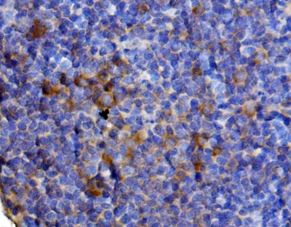 a00077 2 il13 primary antibodies ihc testing 3