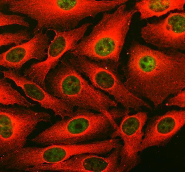 a00079 3 vhl primary antibodies if testing 1