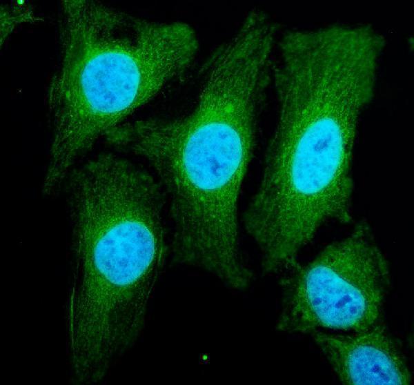 a00079 3 vhl primary antibodies if testing 1_1