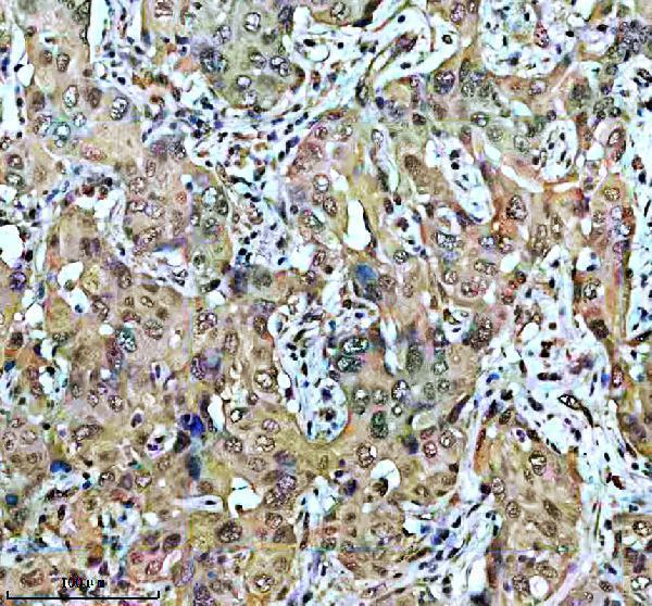 a00079 3 vhl primary antibodies ihc testing 1