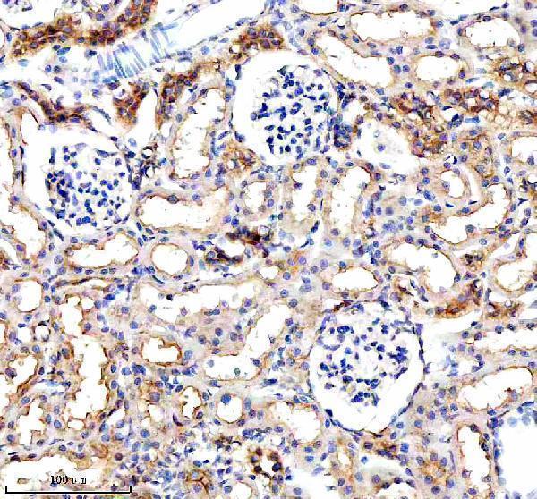  IHC analysis of VHL using anti-VHL antibody (A00079-3)