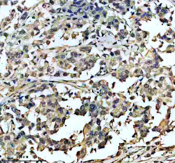 a00079 3 vhl primary antibodies ihc testing 2_1