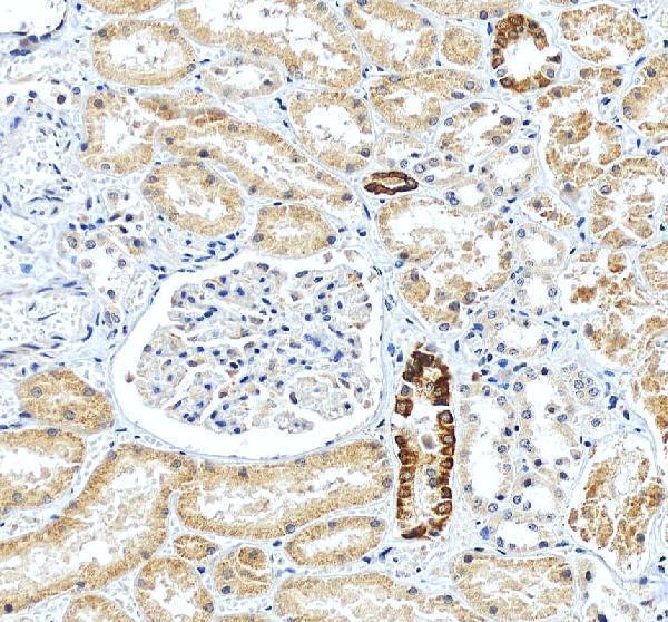 a00079 3 vhl primary antibodies ihc testing 3