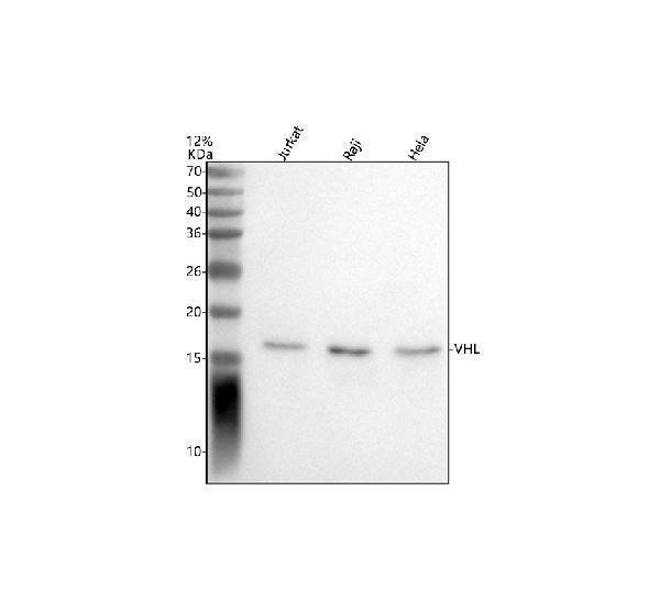  Western blot analysis of VHL using anti-VHL antibody (A00079-3)