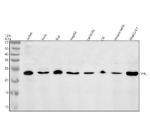 Western blot analysis of VHL using anti-VHL antibody (A00079-3)