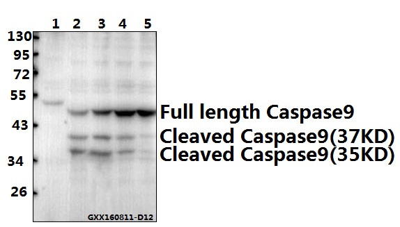 Western blot (WB) analysis of Caspase 9 (E119) polyclonal antibody at 1:500 dilution
Lane1:CT26 whole cell lysate
Lane2:L02 treated with PBS(1×PBS,PH7