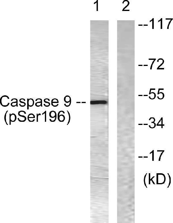 Western blot analysis of lysates from 293 cells treated with Calyculin 50nM 30
