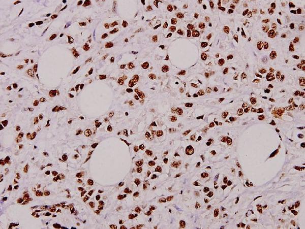 a00080t125 casp9 primary antiboties ihc testing 2