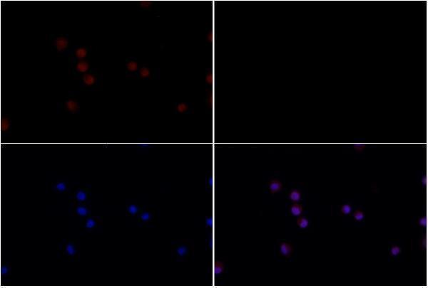Immunofluorescence analysis of Jurkat cells using Caspase 9 (Tyr153) pAb at dilution of 1:50 (40x lens)