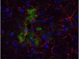 a00081 2 app primary antibodies if testing 1