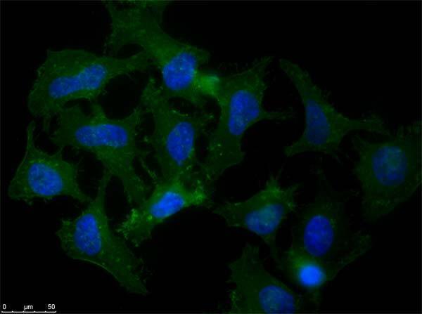 a00081 2 app primary antibodies if testing 5