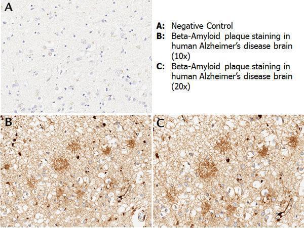 a00081 2 app primary antibodies ihc testing 2