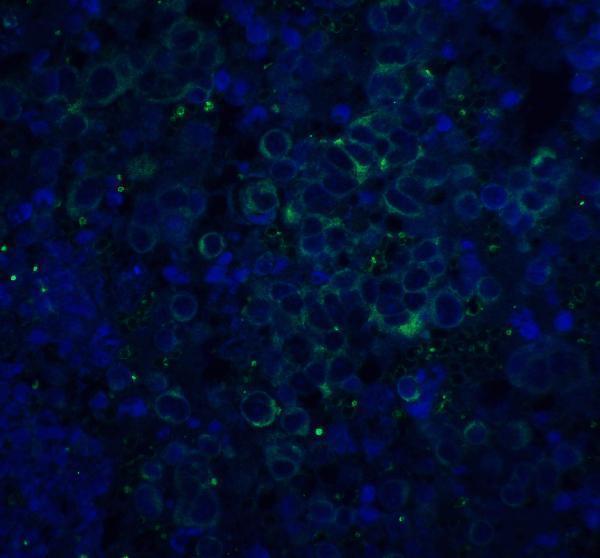 a00081 app primary antibodies if testing 5