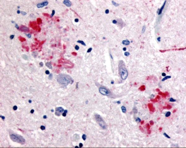 Immunohistochemistry of APP in human brain (Alzheimer