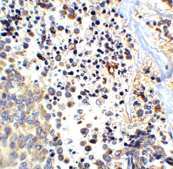 a00081 app primary antibodies ihc testing 4
