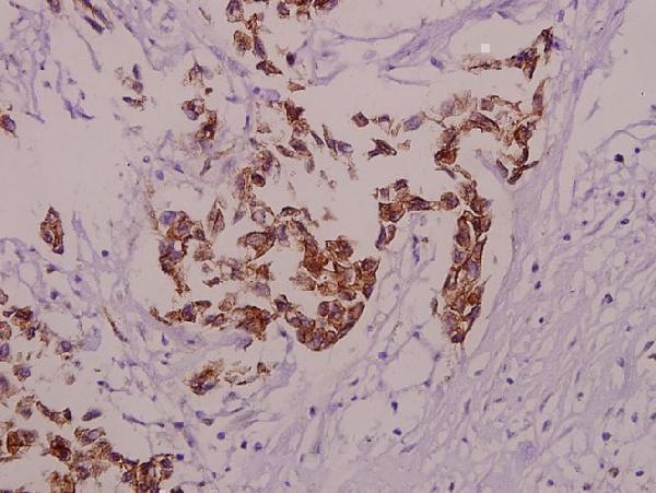 a00081t668 1 app primary antiboties ihc testing 2