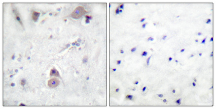 a00081t743 app primary antibodies ihc testing 4