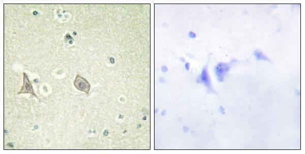 Immunohistochemistry analysis of paraffin-embedded human brain, using M-CSF Receptor (Phospho-Tyr723) Antibody