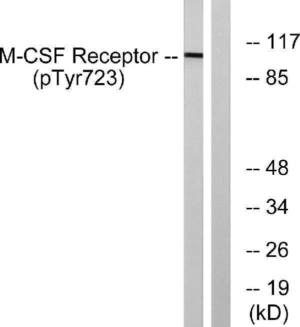 Western blot analysis of lysates from HUVEC cells treated with PMA 125ng/ml 30', using M-CSF Receptor (Phospho-Tyr723) Antibody