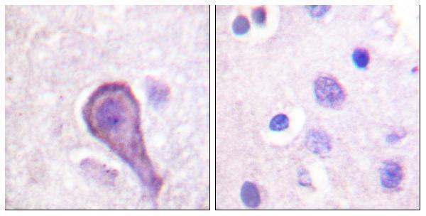 Immunohistochemistry analysis of paraffin-embedded human brain tissue, using Rhodopsin Antibody