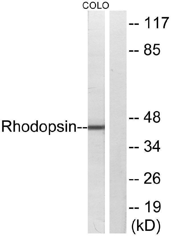 Western blot analysis of lysates from COLO cells, using Rhodopsin Antibody