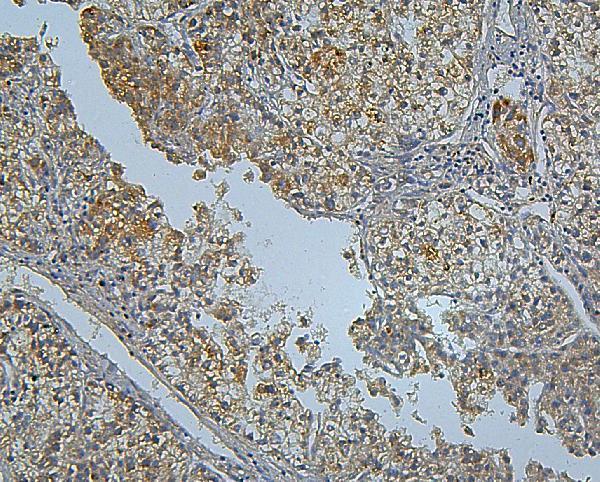  IHC analysis of PCSK9 using anti PCSK9 antibody (A00085-1)