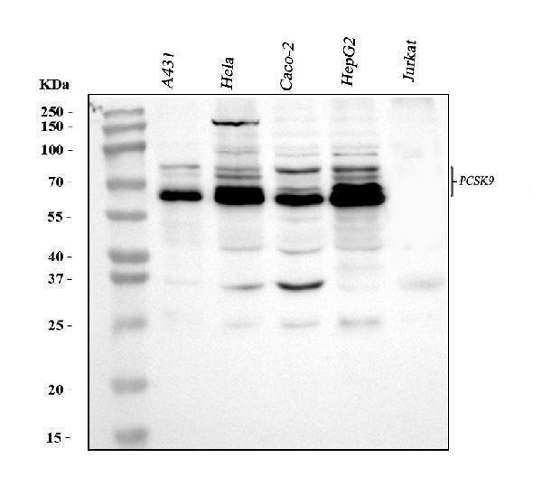 Western blot analysis of PCSK9 using anti-PCSK9 antibody (A00085-1)