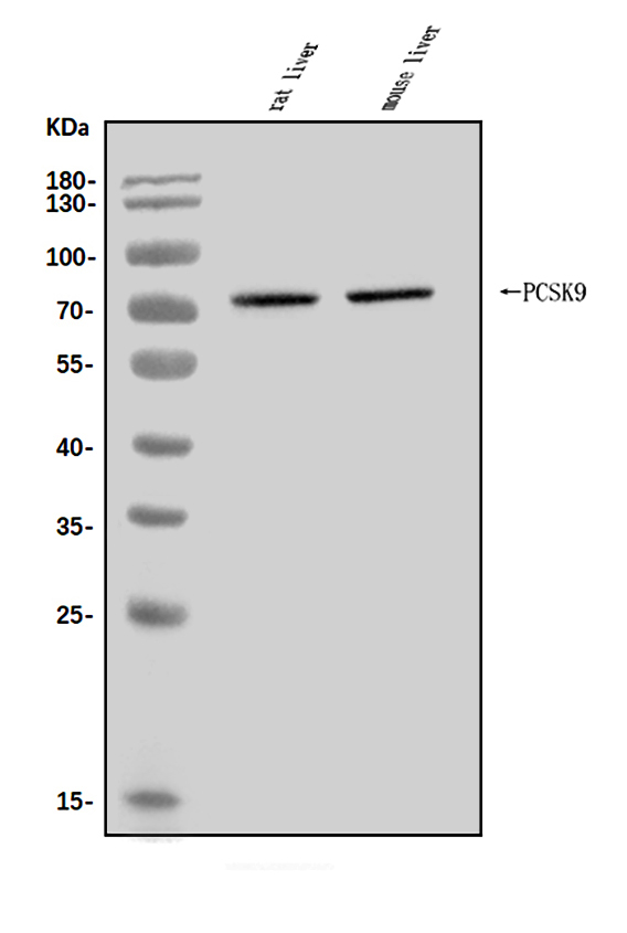  Western blot analysis of PCSK9/Pcsk9 using anti-PCSK9/Pcsk9 antibody (A00085-2)