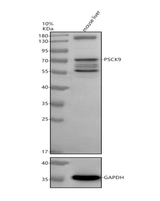 Western blot analysis of PCSK9 using anti-PCSK9 antibody (A00085-2)