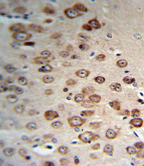 a00085 3 anti pcsk9 antibody n term ihc p testing 6