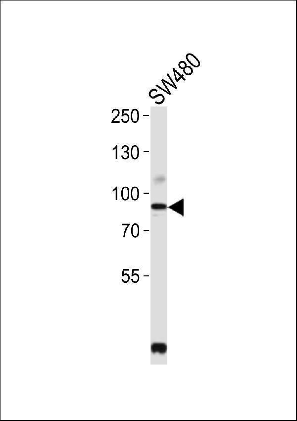a00085 3 anti pcsk9 antibody n term wb testing 1