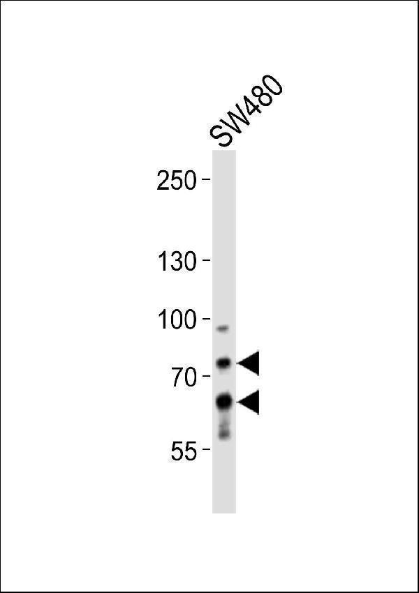 a00085 3 anti pcsk9 antibody n term wb testing 2