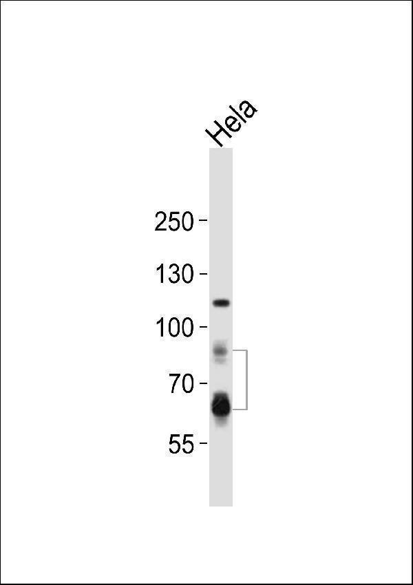 a00085 3 anti pcsk9 antibody n term wb testing 3