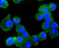 ICC staining RUNX1+RUNX2+RUNX3 in N2A cells (green)