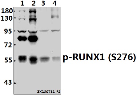 Western blot (WB) analysis of p-RUNX1 (S276) pAb at 1:500 dilution
Lane1:Myla2059 whole cell lysate(30ug)
Lane2:K562 whole cell lysate(40ug)
Lane3:The Thymus tissue lysate of Rat(40ug)
Lane4:3T3-L1 whole cell lysate(40ug)