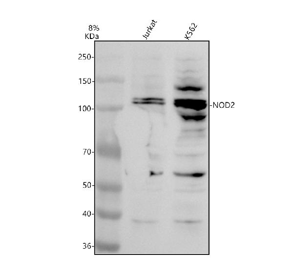 Western blot analysis of NOD2 using anti-NOD2 antibody (A00087-2)