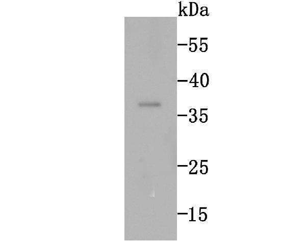 Western blot analysis of various lysates, using Rad51 antibody  at  1:440 dilution