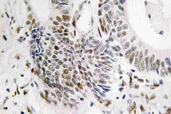 a00088t309 rad51 primary antiboties ihc testing 2